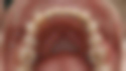 连云港赣榆春来口腔诊所口碑评价