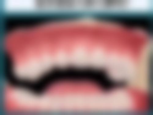 咸宁种植牙医生在线询问24小时——湖北科技学院口腔医院考察