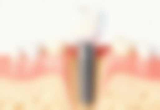 内蒙古镶假牙医生24小时在线询问：了解医院