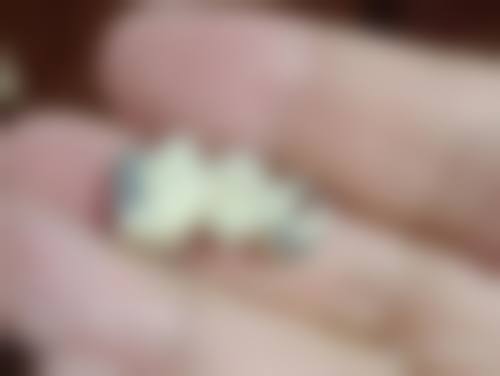 影响德韩口腔种植牙价格的因素