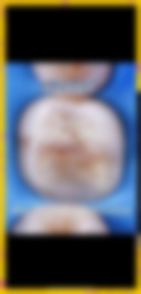 种牙2880元起：喜乐口腔种牙性价比解析