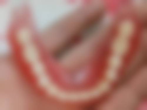 9岁孩子门牙不齐的矫正方法