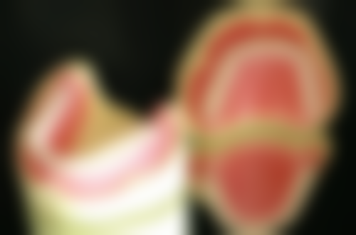 根管治疗和杀神经的治疗过程差异