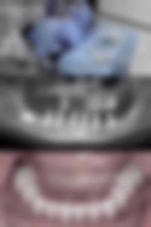 汕尾种植牙医生24小时在线询问之张培华口腔诊所探秘