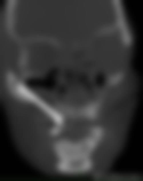 {汕尾种植牙医生24小时在线咨询，我刚咨询完，挖到了本地种牙的靠谱攻略与实惠价