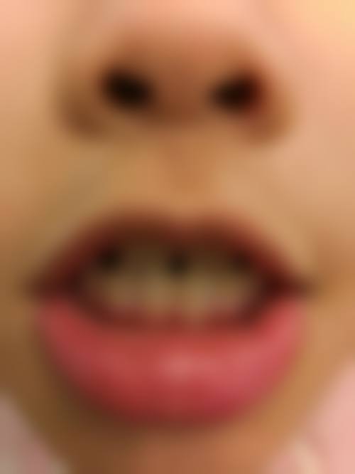 连云港灌南程映霞口腔收费贵吗？