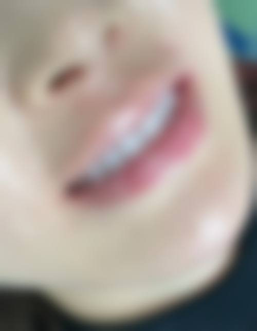 连云港灌南程映霞口腔环境和服务如何？