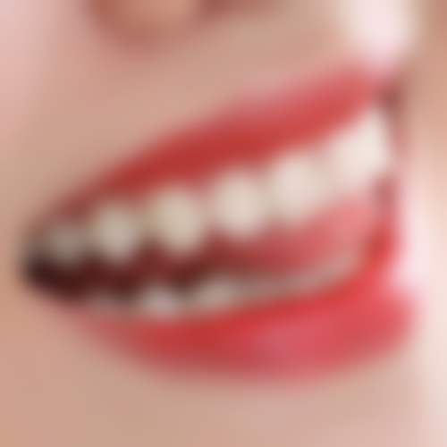 北京百诺口腔门诊部（清河分院）收费价格表/收费标准