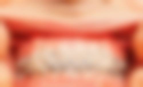 儿童矫正牙齿价格表：矫正方式、牙齿状况、地区差异如何影响费用？ 