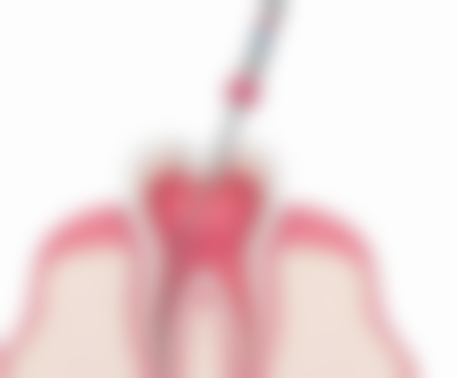 湛江镶牙医生24小时在线询问之总结与感慨