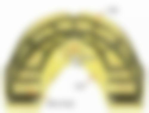 46 岁矫正深覆合牙齿医生的经验特别关键