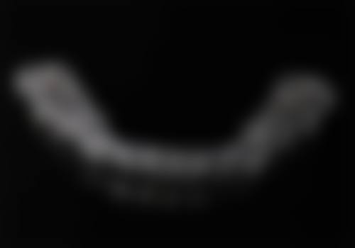 35岁矫正牙齿的注意事项