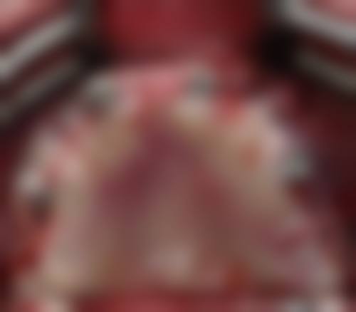 三、2026集采后瑞士种植牙价格体系大揭秘