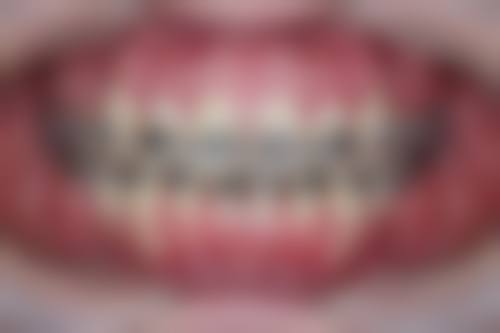 丹东金属矫正医生在线询问24小时：探寻靠谱医生