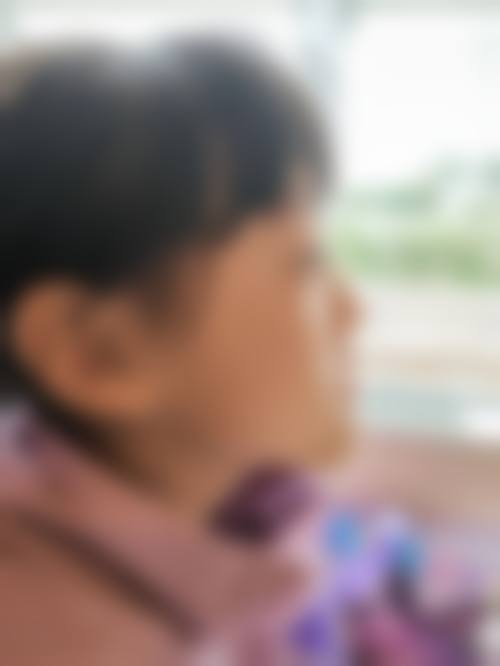 13岁矫正牙齿，地包天矫正时机、戴牙套副作用及矫正价格详情！ 