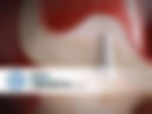 新贝尔口腔牙齿美白的优势亮点