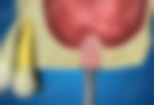 探寻月牙口腔牙齿美白的独特魅力