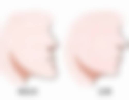 宝宝地包天怎么辨认：口腔习惯排查法