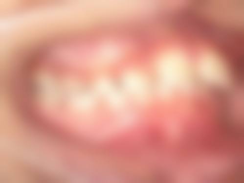 其他影响矫正价格的因素