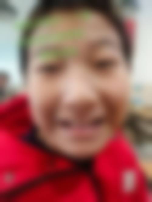 宝宝地包天怎么辨认：遗传因素参考法