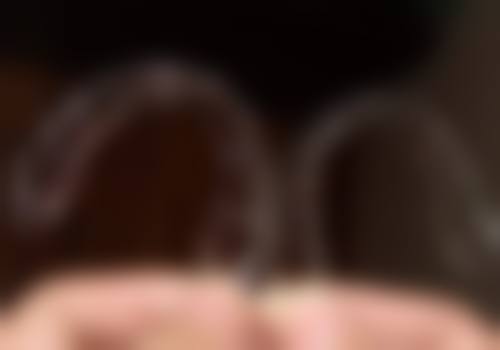 25岁还能做牙齿正畸吗？可以！牙周健康就能改善排列与咬合功能