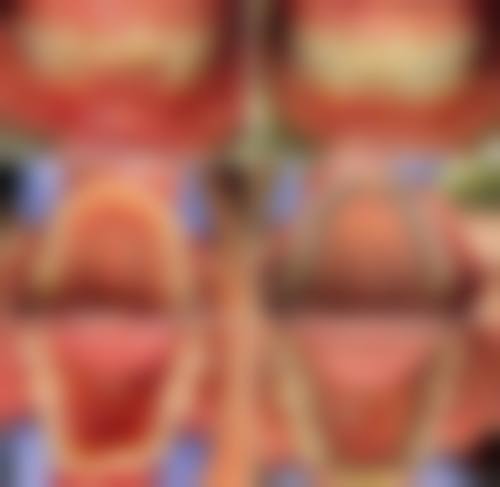 上饶舌侧矫正医生24小时在线询问之医生技术优势