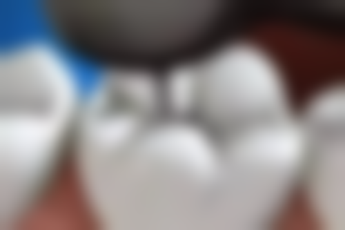 四、麦芽口腔精良技术，数字化治疗更精细