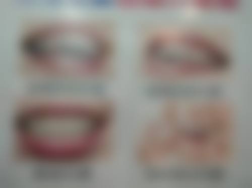 深圳麦芽口腔医院地址在哪里？7家分院覆盖罗湖福田南山，地铁直达可预约