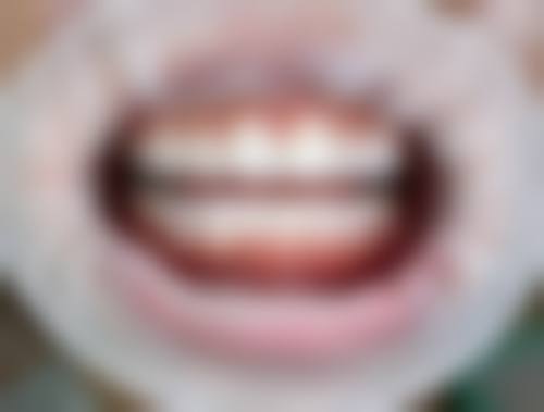 内蒙古呼和浩特李芝叶口腔诊所价格与联系方式