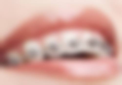 总结展望：湖北十堰品冠口腔(北京路店)矫正前景可期