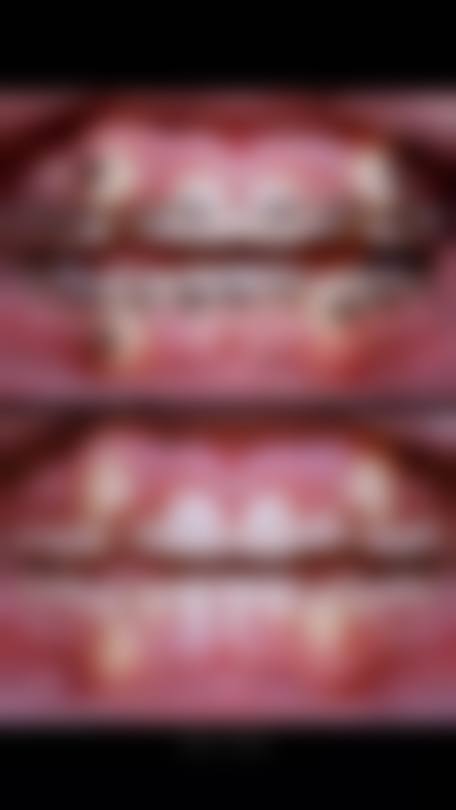 常见矫正方式及价格区间