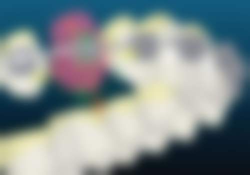 儿童牙齿矫正要好多钱：作者：林夕