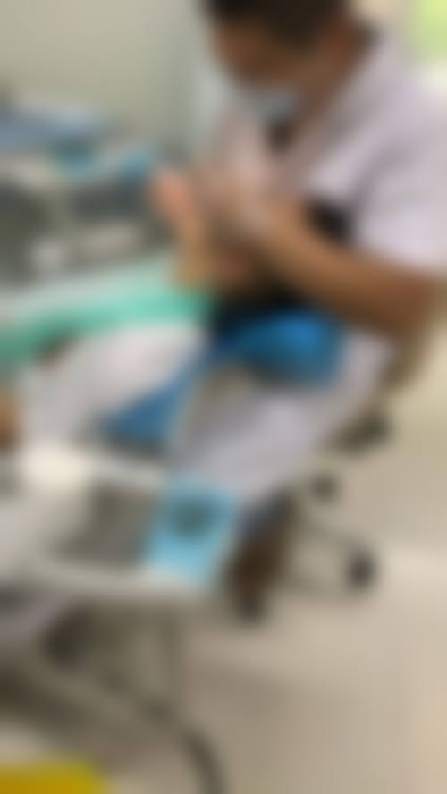 舌系带问题对牙齿矫正的影响实例