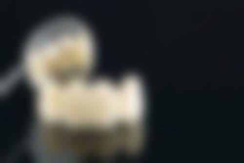七、广州广大口腔数字化全冠修复的优势对比