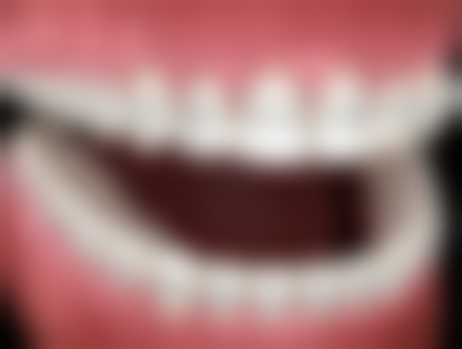 六、邵阳隆回县雅贝康&牙博士口腔(城东机构)口碑怎么样?真人好评反馈