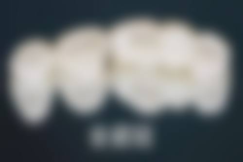 卡尔斯种植牙品牌口碑超棒！SA表面处理+莫氏锥度连接，性价比超高！ 
