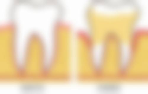 上海伊尔意口腔——连锁布局与复杂种植经验兼备