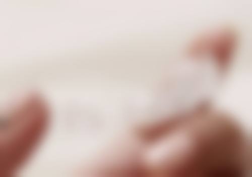 舌侧矫正的优缺点：优点是美观定制伤害小速度快，缺点是费用高清洁难适应差 