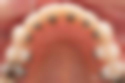深圳瑞致口腔门诊部患者真实反馈回答口碑怎么样？