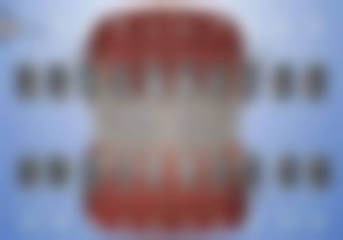 8岁儿童牙齿校正：总结与建议