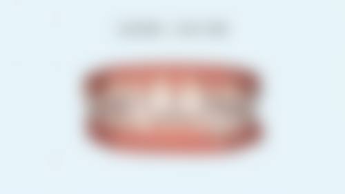 25岁了还适合矫正牙齿吗？年龄非限制因素，关键看牙周和咬合状况！ 