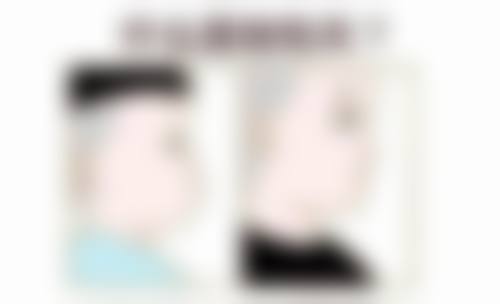 不同年龄段手术特点：各有优劣需谨慎考量