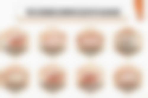 28岁牙齿矫正的成效和保持