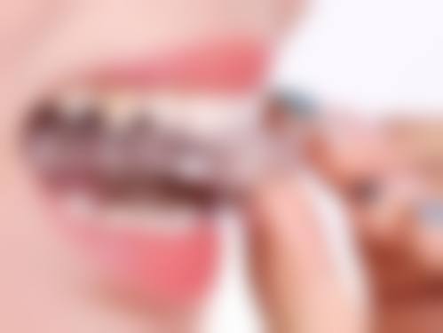 黄石华玉口腔技术优势