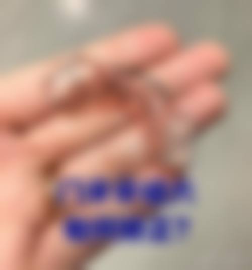 如何预约许卓医生及费用相关注意事项