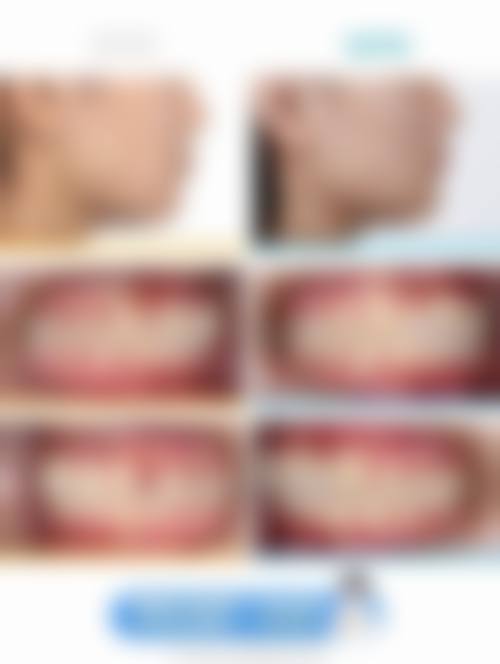 杭州维恩口腔怎么样?