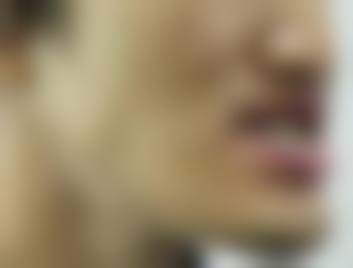 林霜擅长项目
