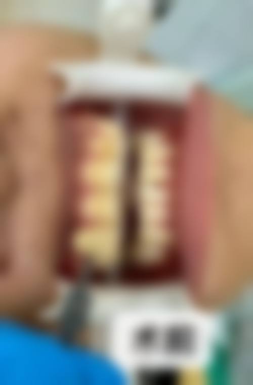 济南历城乐雅口腔项目与价格介绍