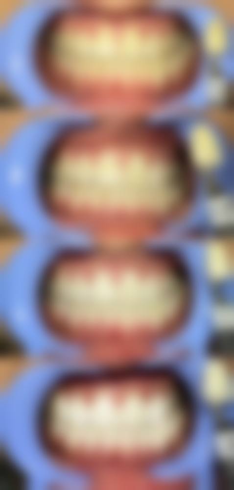 晋江牙齿美白医院的技术优势