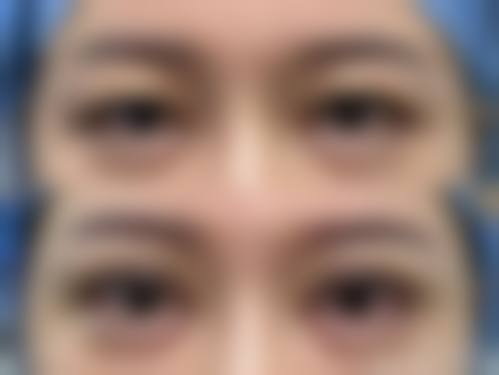 优惠活动详情